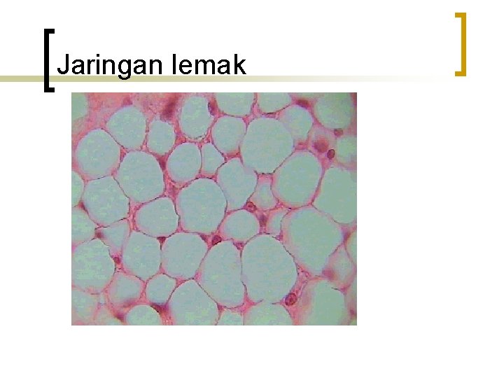 Jaringan lemak 