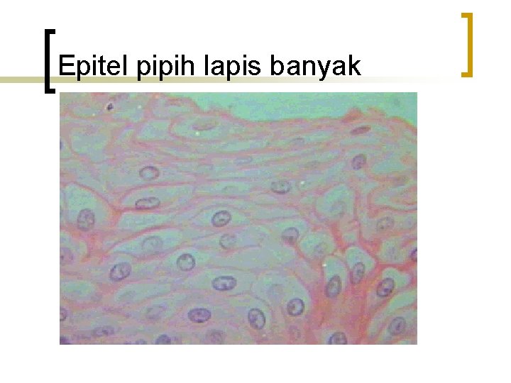 Epitel pipih lapis banyak 