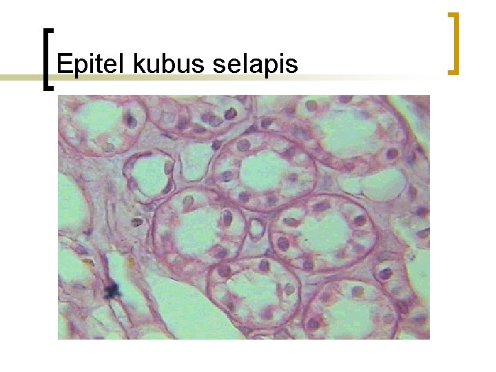 Epitel kubus selapis 