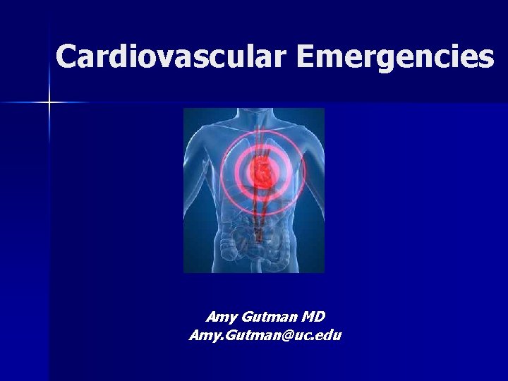 Cardiovascular Emergencies Amy Gutman MD Amy. Gutman@uc. edu 