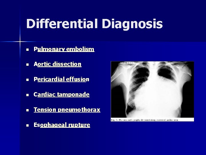 Differential Diagnosis n Pulmonary embolism n Aortic dissection n Pericardial effusion n Cardiac tamponade