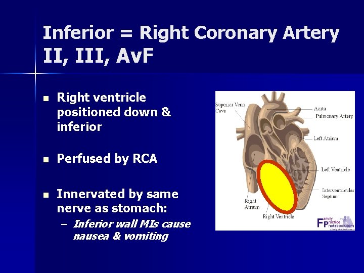 Inferior = Right Coronary Artery II, III, Av. F n Right ventricle positioned down