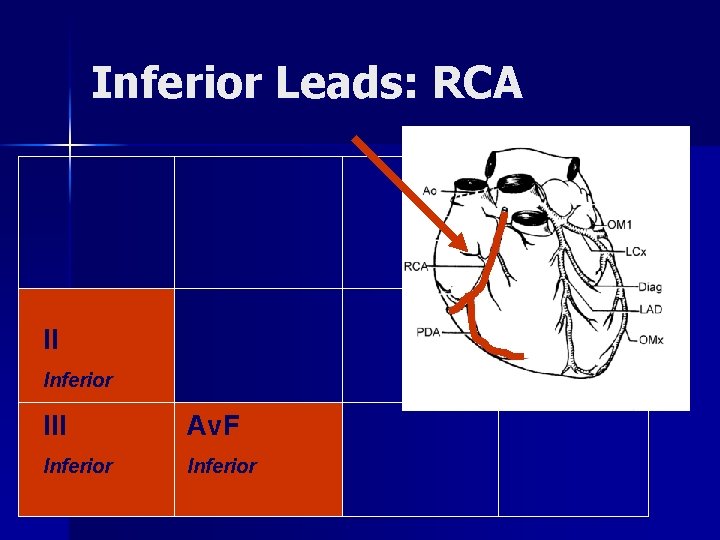 Inferior Leads: RCA II Inferior III Av. F Inferior 