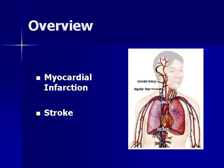 Overview n Myocardial Infarction n Stroke 