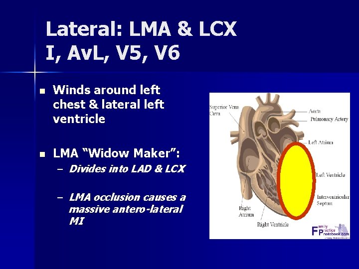 Lateral: LMA & LCX I, Av. L, V 5, V 6 n Winds around