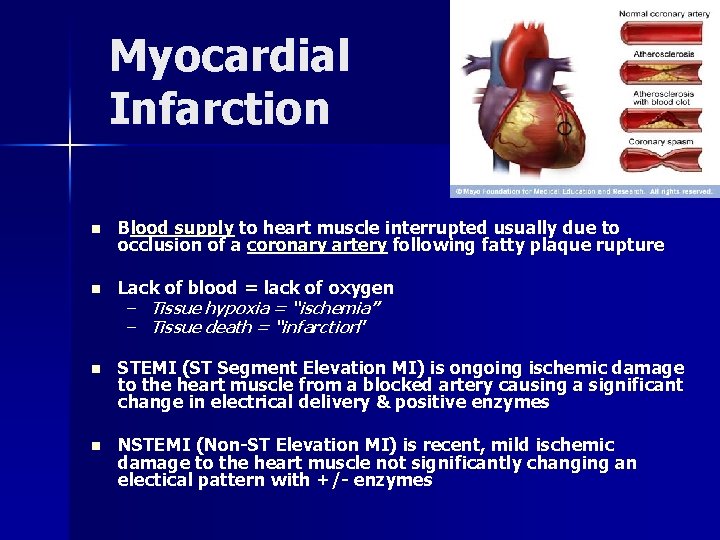 Myocardial Infarction n Blood supply to heart muscle interrupted usually due to occlusion of