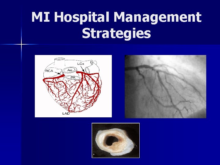 MI Hospital Management Strategies 