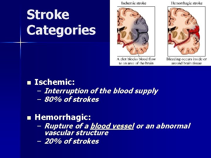 Stroke Categories n Ischemic: n Hemorrhagic: – Interruption of the blood supply – 80%