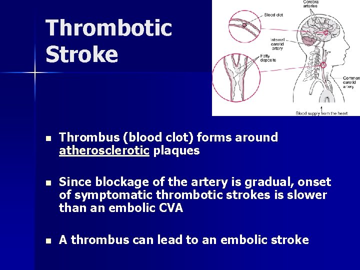 Thrombotic Stroke n Thrombus (blood clot) forms around atherosclerotic plaques n Since blockage of