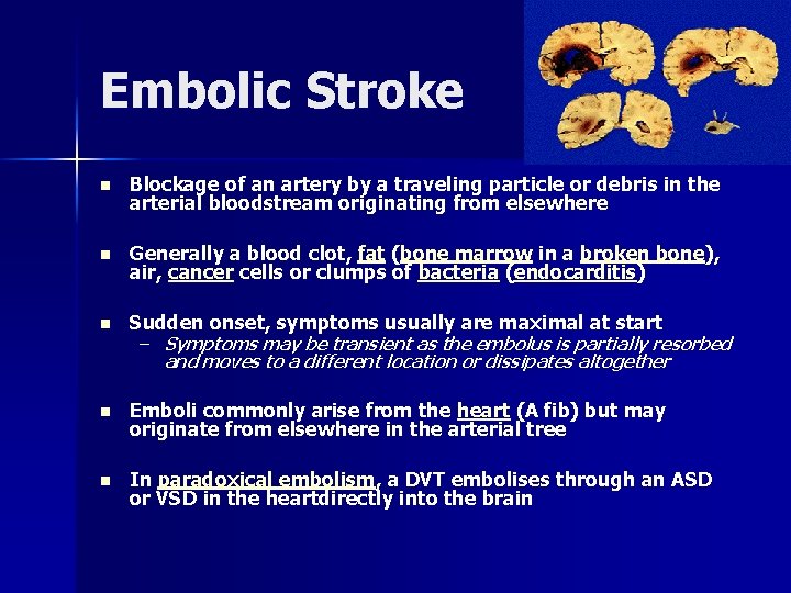 Embolic Stroke n Blockage of an artery by a traveling particle or debris in