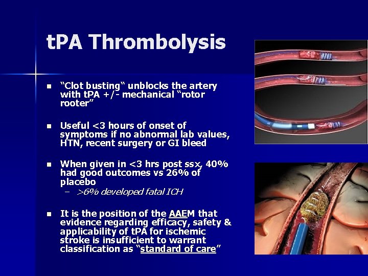 t. PA Thrombolysis n “Clot busting“ unblocks the artery with t. PA +/- mechanical