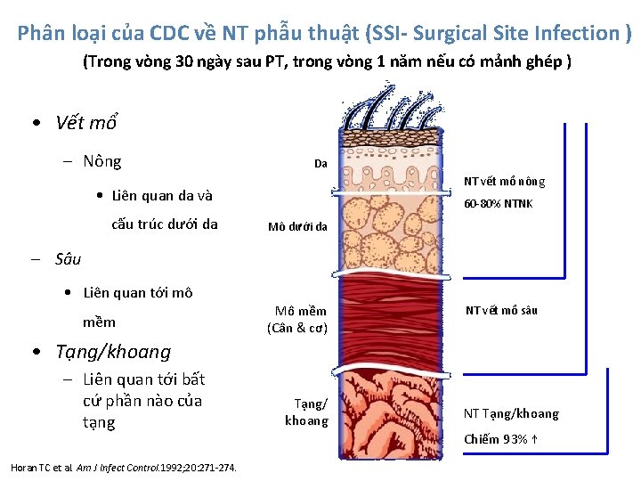 Phân loại của CDC về NT phẫu thuật (SSI- Surgical Site Infection ) (Trong
