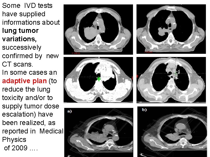 Some IVD tests have supplied informations about lung tumor variations, successively confirmed by new