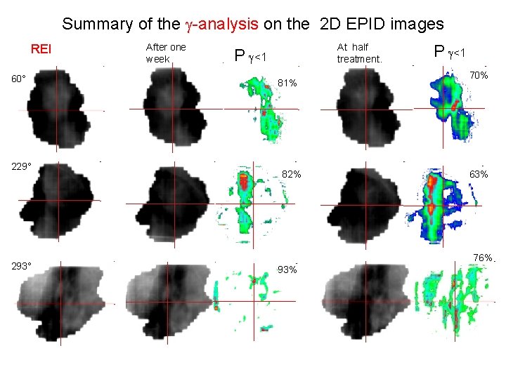 Summary of the g-analysis on the 2 D EPID images REI 60° 229° 293°