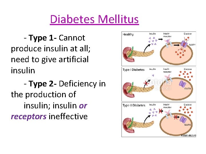 Diabetes Mellitus - Type 1 - Cannot produce insulin at all; need to give