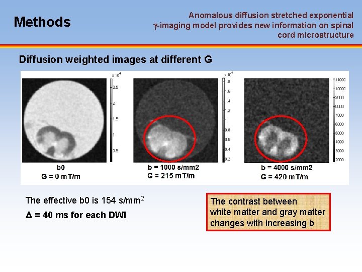 Methods Anomalous diffusion stretched exponential -imaging model provides new information on spinal cord microstructure