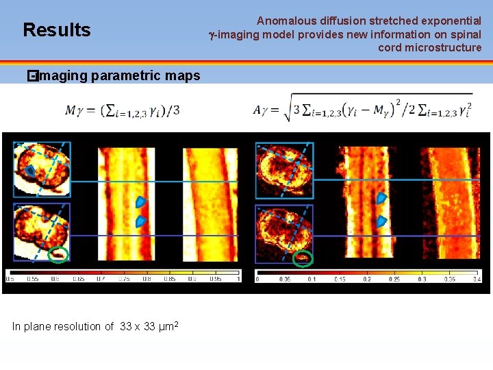 Results � -imaging parametric maps In plane resolution of 33 x 33 µm 2