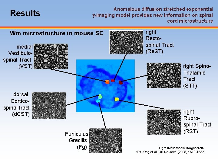 Anomalous diffusion stretched exponential -imaging model provides new information on spinal cord microstructure Results