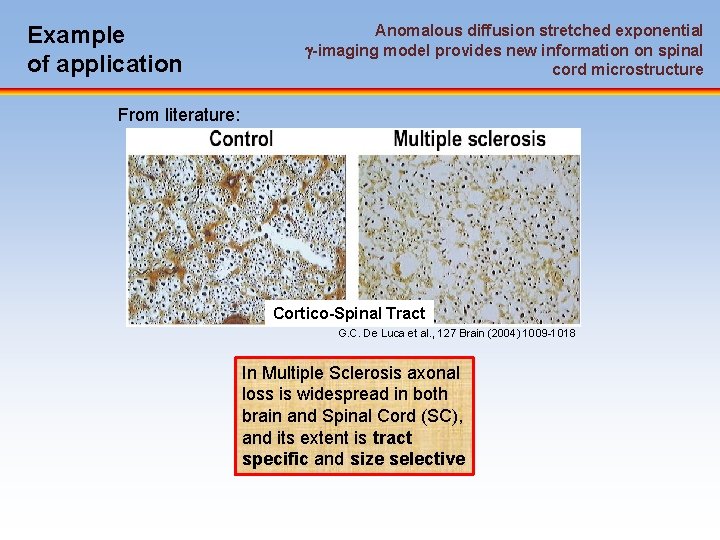 Example of application Anomalous diffusion stretched exponential -imaging model provides new information on spinal