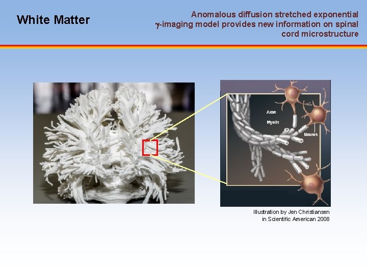 White Matter Anomalous diffusion stretched exponential -imaging model provides new information on spinal cord
