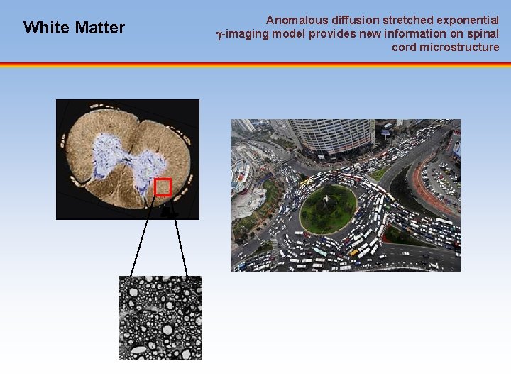 White Matter Anomalous diffusion stretched exponential -imaging model provides new information on spinal cord