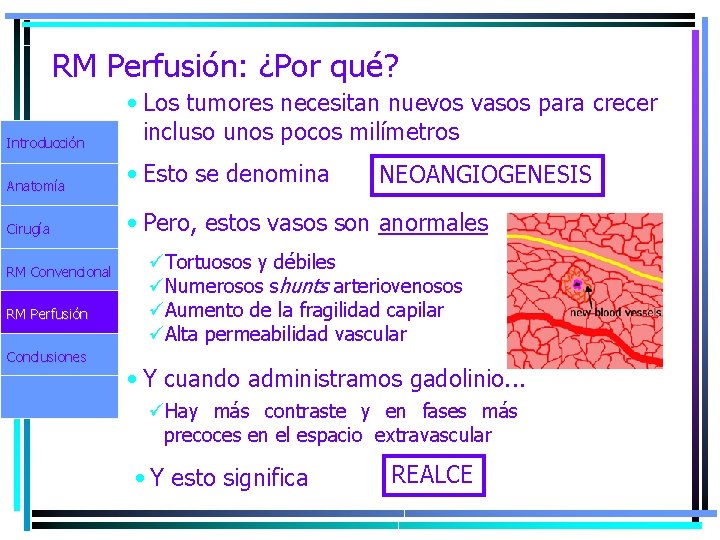 RM Perfusión: ¿Por qué? Introducción Anatomía Cirugía RM Convencional RM Perfusión Conclusiones • Los