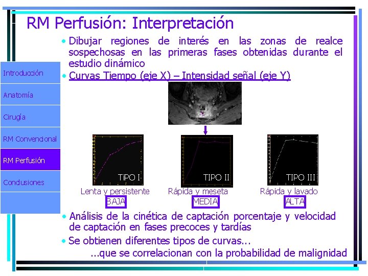 RM Perfusión: Interpretación Introducción • Dibujar regiones de interés en las zonas de realce