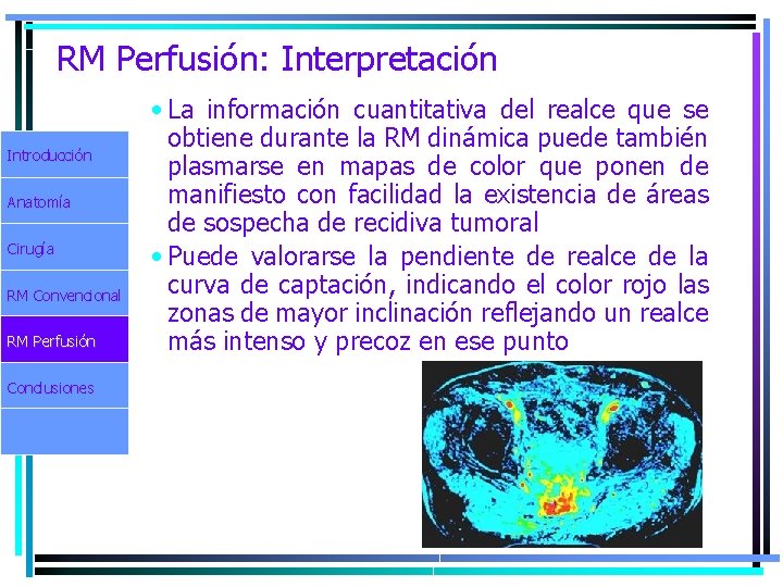 RM Perfusión: Interpretación Introducción Anatomía Cirugía RM Convencional RM Perfusión Conclusiones • La información