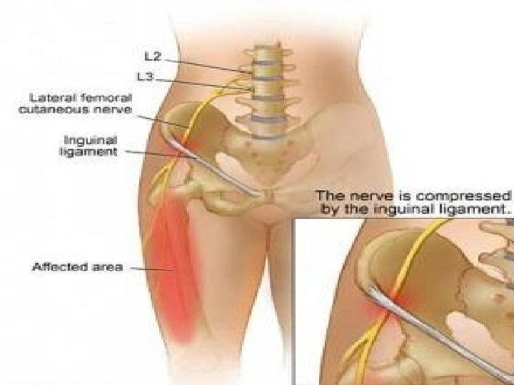 2. . . femoral nerve (L 2 -L 4) o Largest branch of the