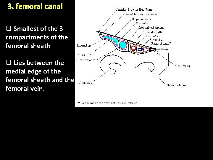 3. femoral canal q Smallest of the 3 compartments of the femoral sheath q