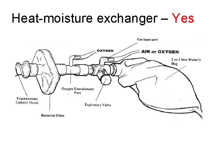 Heat-moisture exchanger – Yes 