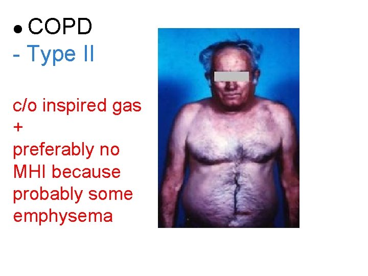  COPD - Type II c/o inspired gas + preferably no MHI because probably