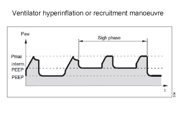 Ventilator hyperinflation or recruitment manoeuvre 