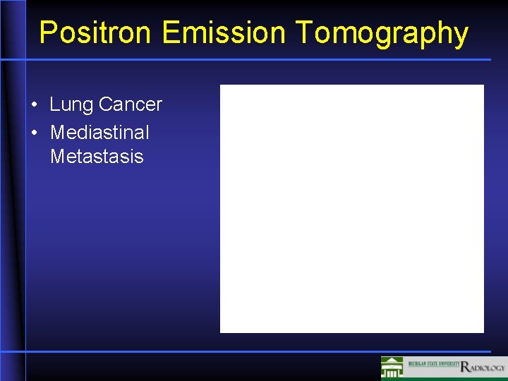 Positron Emission Tomography • Lung Cancer • Mediastinal Metastasis 