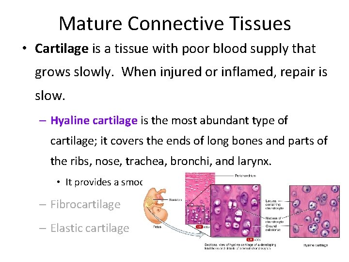 Mature Connective Tissues • Cartilage is a tissue with poor blood supply that grows