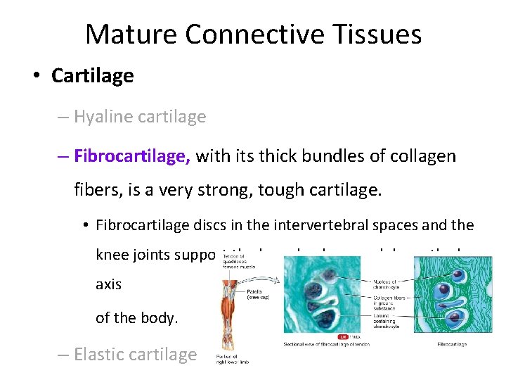 Mature Connective Tissues • Cartilage – Hyaline cartilage – Fibrocartilage, with its thick bundles