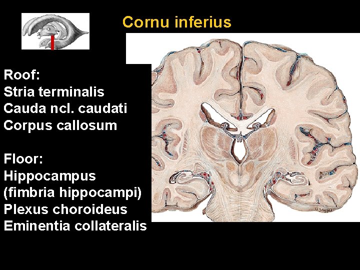 Cornu inferius Roof: Stria terminalis Cauda ncl. caudati Corpus callosum Floor: Hippocampus (fimbria hippocampi)
