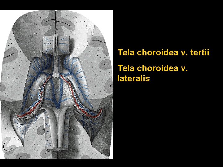 Tela choroidea v. tertii Tela choroidea v. lateralis 