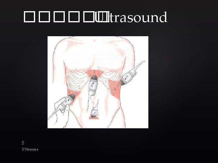 ������ Ultrasound 5 S. Vorasane 