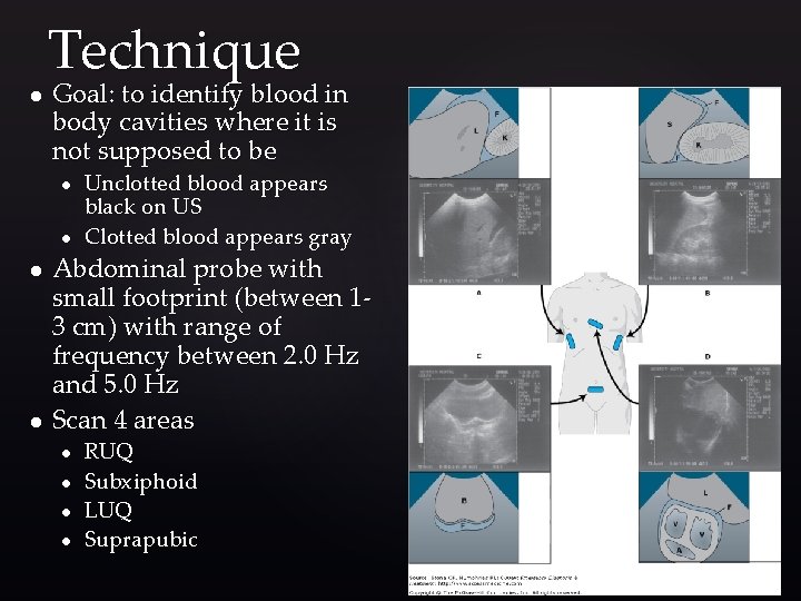 Technique l Goal: to identify blood in body cavities where it is not supposed