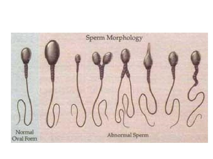 Sperm Condition Biology of Fertility Control What You Should Know
