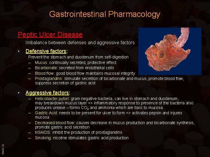 Gastrointestinal Pharmacology Peptic Ulcer Disease Imbalance between defenses and aggressive factors • Defensive factors: Gastrointestinal Pharmacology Peptic Ulcer Disease Imbalance between defenses and aggressive factors • Defensive factors: