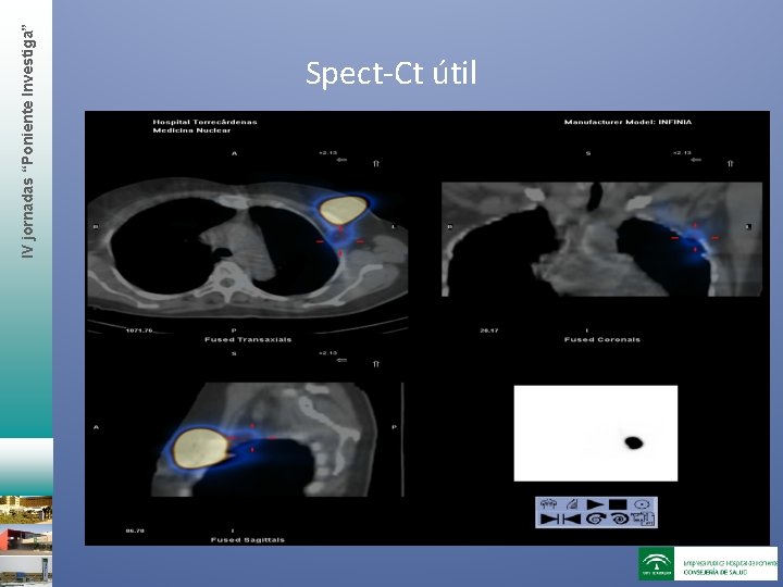 IV jornadas “Poniente Investiga” Spect-Ct útil 