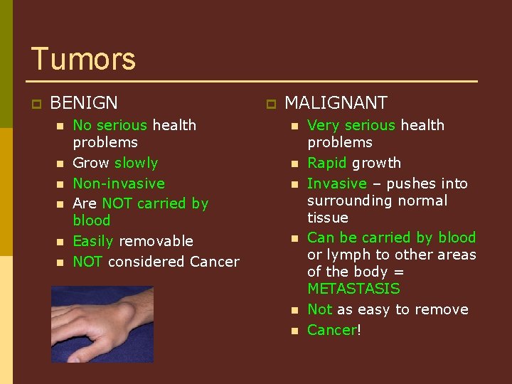 Tumors p BENIGN n n n No serious health problems Grow slowly Non-invasive Are