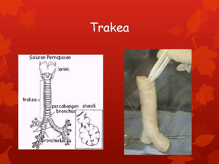 Trakea 