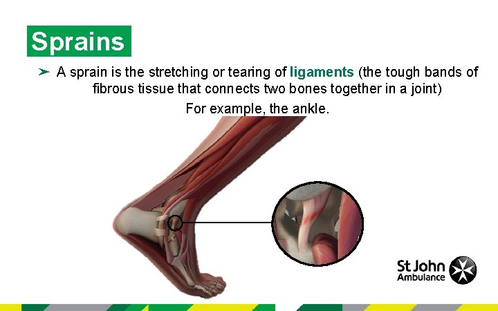 Bone muscle and joint injuries KS 4 Bone