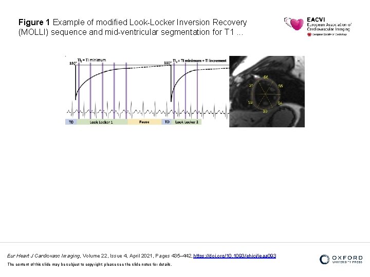 Figure 1 Example of modified Look-Locker Inversion Recovery (MOLLI) sequence and mid-ventricular segmentation for