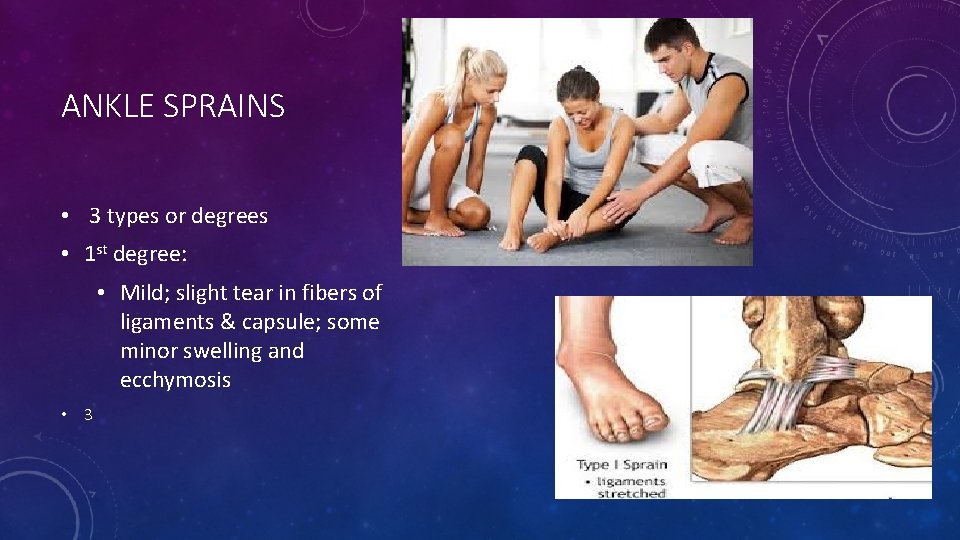 ANKLE SPRAINS • 3 types or degrees • 1 st degree: • Mild; slight