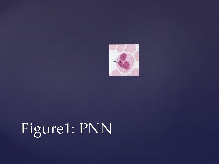 Figure 1: PNN 