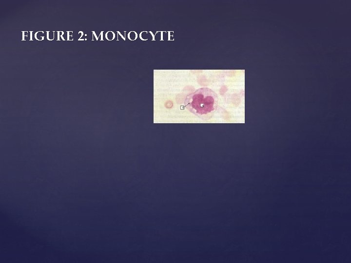 FIGURE 2: MONOCYTE 